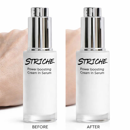 Striche Skin Lift™