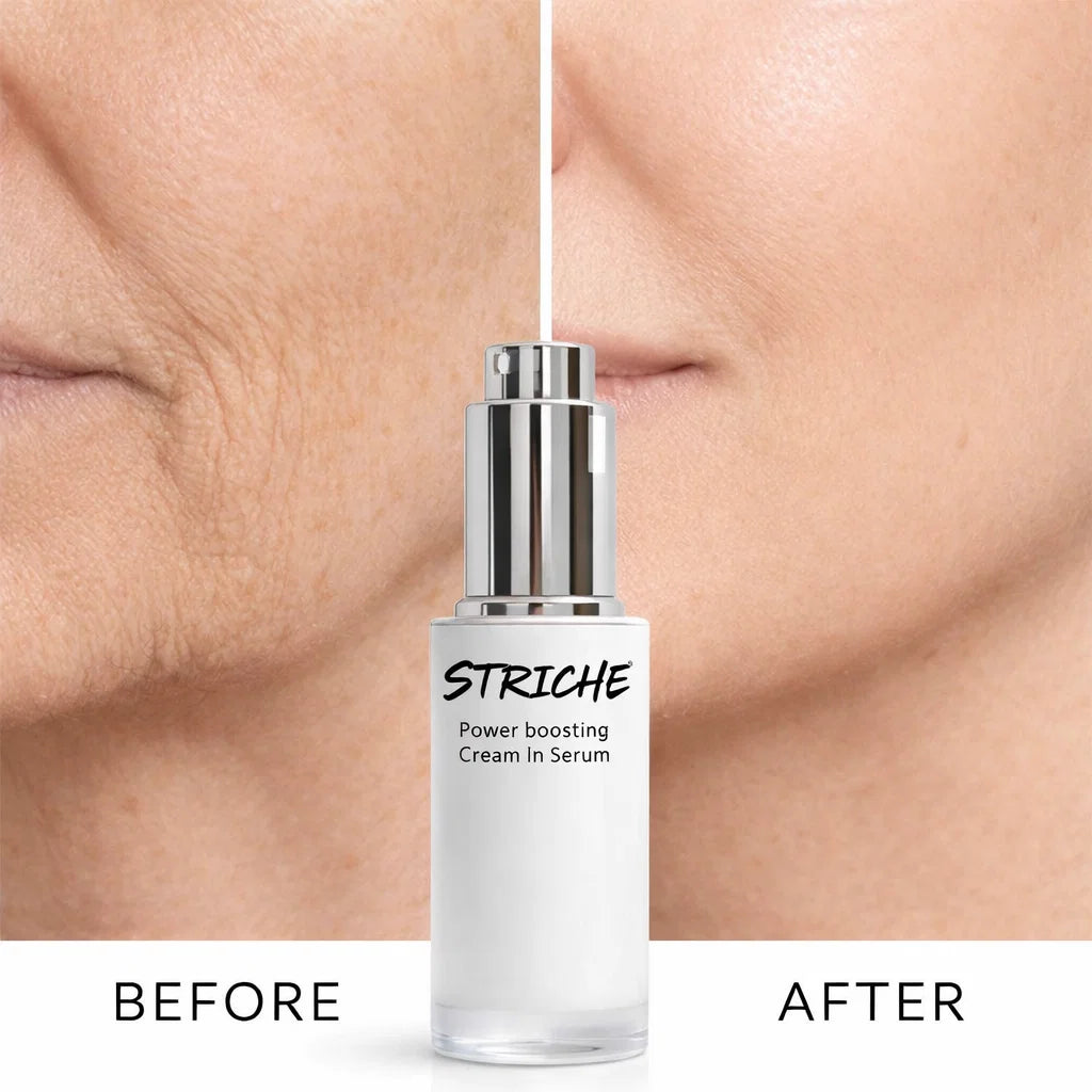 Striche Skin Lift™