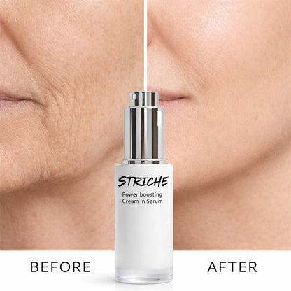 Striche Skin Lift™